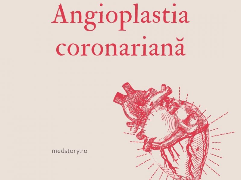 Angioplastia coronariană cu stent